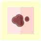 ten_patat_85